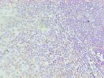 hnRNP D Antibody in Immunohistochemistry (Paraffin) (IHC (P))