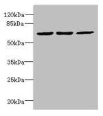 CPSF3L Antibody in Western Blot (WB)