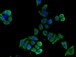 SLC16A9 Antibody in Immunocytochemistry (ICC/IF)