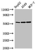 SLC24A5 Antibody in Western Blot (WB)
