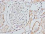 CYP4V2 Antibody in Immunohistochemistry (Paraffin) (IHC (P))