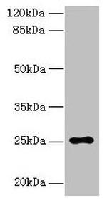 ARPIN Antibody in Western Blot (WB)