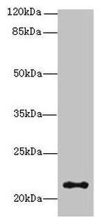 JAGN1 Antibody in Western Blot (WB)