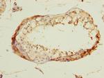 DBF4B Antibody in Immunohistochemistry (Paraffin) (IHC (P))