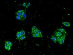 ZNF645 Antibody in Immunocytochemistry (ICC/IF)