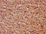 KTI12 Antibody in Immunohistochemistry (Paraffin) (IHC (P))