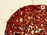 PIGK Antibody in Immunohistochemistry (Paraffin) (IHC (P))