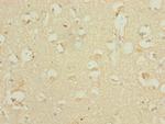 DHTKD1 Antibody in Immunohistochemistry (Paraffin) (IHC (P))