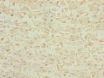 DHTKD1 Antibody in Immunohistochemistry (Paraffin) (IHC (P))