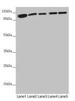 DHTKD1 Antibody in Western Blot (WB)