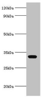 AGPAT1 Antibody in Western Blot (WB)