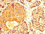 MYOC Antibody in Immunohistochemistry (Paraffin) (IHC (P))