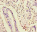 TDRD3 Antibody in Immunohistochemistry (Paraffin) (IHC (P))