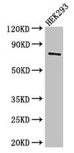 TDRD3 Antibody in Western Blot (WB)