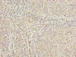 MED18 Antibody in Immunohistochemistry (Paraffin) (IHC (P))