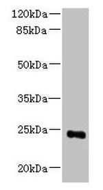 MED18 Antibody in Western Blot (WB)