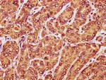 RANBP17 Antibody in Immunohistochemistry (Paraffin) (IHC (P))