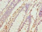 TUBB6 Antibody in Immunohistochemistry (Paraffin) (IHC (P))