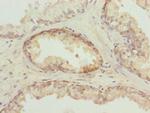 TUBB6 Antibody in Immunohistochemistry (Paraffin) (IHC (P))