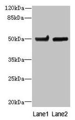 TUBB6 Antibody in Western Blot (WB)