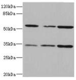 IL17RB Antibody in Western Blot (WB)