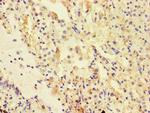 UVRAG Antibody in Immunohistochemistry (Paraffin) (IHC (P))