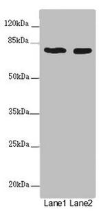 UVRAG Antibody in Western Blot (WB)