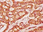 PACSIN2 Antibody in Immunohistochemistry (Paraffin) (IHC (P))