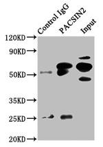 PACSIN2 Antibody in Western Blot (WB)