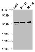 PACSIN2 Antibody in Western Blot (WB)