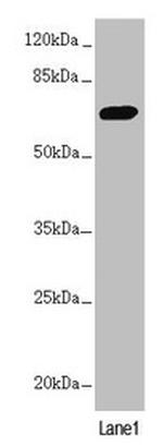 PPP2R3B Antibody in Western Blot (WB)