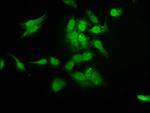 RAD54L2 Antibody in Immunocytochemistry (ICC/IF)