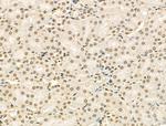 Phospho-FANCG (Ser383) Antibody in Immunohistochemistry (Paraffin) (IHC (P))