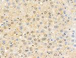 TTK Antibody in Immunohistochemistry (Paraffin) (IHC (P))