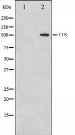 TTK Antibody in Western Blot (WB)