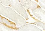 Collagen III Antibody in Immunohistochemistry (Paraffin) (IHC (P))