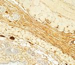 Collagen III Antibody in Immunohistochemistry (Paraffin) (IHC (P))