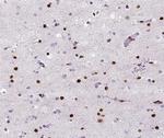 DNA Polymerase beta Antibody in Immunohistochemistry (Paraffin) (IHC (P))