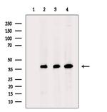 DNA Polymerase beta Antibody in Western Blot (WB)