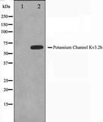 KV3.2 (KCNC2) Antibody in Western Blot (WB)