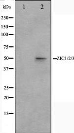ZIC1/ZIC2/ZIC3 Antibody in Western Blot (WB)