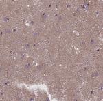 Fibronectin Antibody in Immunohistochemistry (Paraffin) (IHC (P))