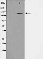 Phospho-NMDAR1 (Ser897) Antibody in Western Blot (WB)