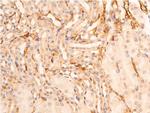 Phospho-Chk1 (Ser280) Antibody in Immunohistochemistry (Paraffin) (IHC (P))