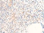 Phospho-Chk1 (Ser280) Antibody in Immunohistochemistry (Paraffin) (IHC (P))