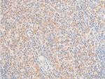 Phospho-TAK1 (Thr187) Antibody in Immunohistochemistry (Paraffin) (IHC (P))
