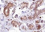 Phospho-Estrogen Receptor alpha (Ser118) Antibody in Immunohistochemistry (Paraffin) (IHC (P))