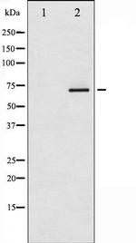 Phospho-Estrogen Receptor alpha (Ser118) Antibody in Western Blot (WB)