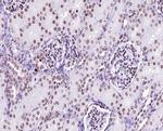 Phospho-LCK (Tyr505) Antibody in Immunohistochemistry (Paraffin) (IHC (P))