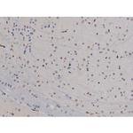 Phospho-Lyn (Tyr508) Antibody in Immunohistochemistry (Paraffin) (IHC (P))